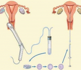 35岁女性备孕请做好以下检查，“健康南昌代生宝宝”跑不远
